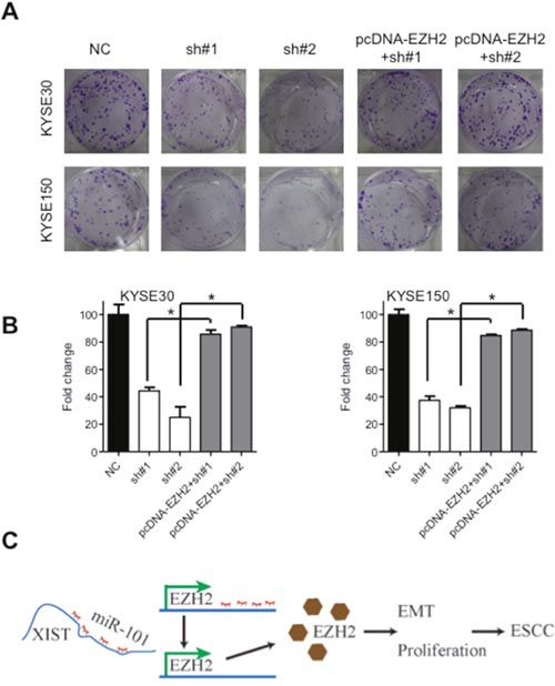Oncogenic activities of XIST is mediated by EZH2.