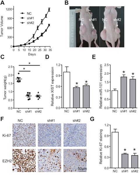 XIST promotes tumor growth of ESCC via regulation of miR-101/EZH2 axis in vivo.