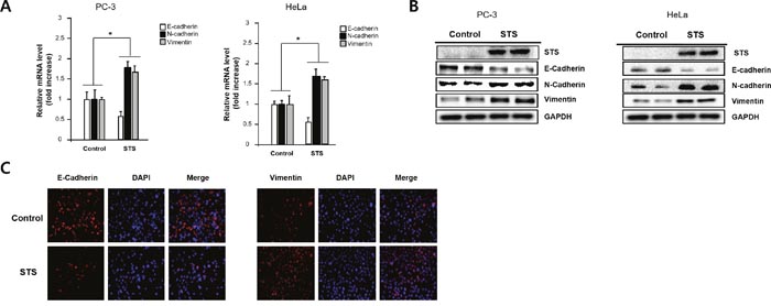 STS induces EMT in both PC-3 and HeLa cells.