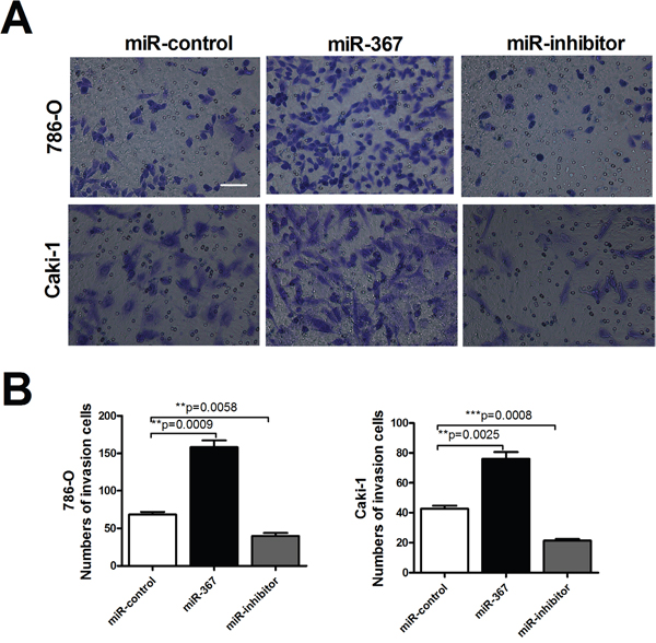MiR-367 increased the number of invasion cells in ccRCC.