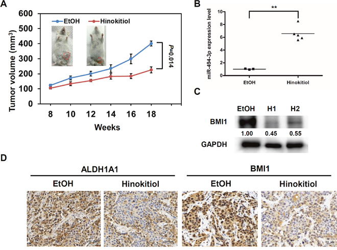 Hinokitiol reduces in vivo tumorigenicity of BCSCs.
