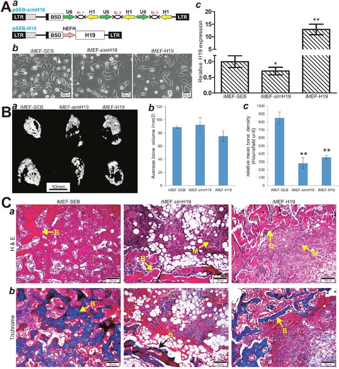 Stable overexpression and silencing of lncRNA H19 inhibit BMP9-induced ectopic bone formation in vivo.