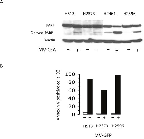 Measles virus treatment induces apoptosis in mesothelioma.