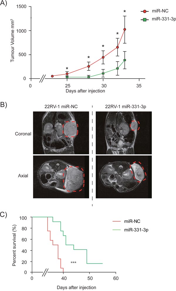miR-331-3p inhibits PCa xenograft tumor growth.