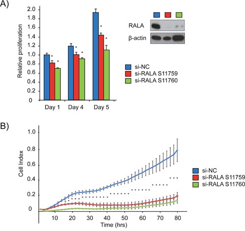 siRNA mediated inhibition of RALA expression reduces proliferation of PCa cells.