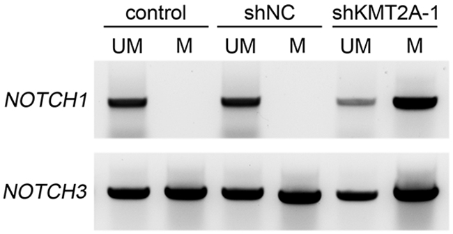 Methylation-specific PCR reveals NOTCH1 and NOTCH3 methylation patterns in U-87 MG cell line.