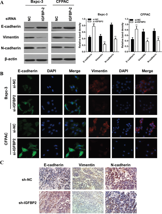 Knockdown of IGFBP-2 attenuates EMT of pancreatic cancer cells.