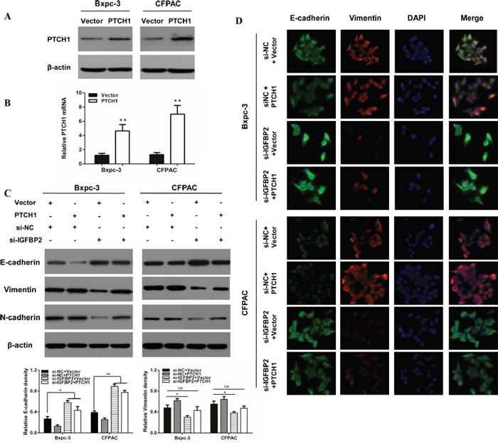 Overexpression of PTCH1 prevents the impact of silencing IGFBP-2 on EMT markers.