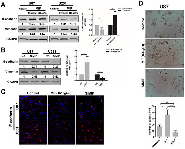 MIF enhances the EMT and VM formation in GBM cells.