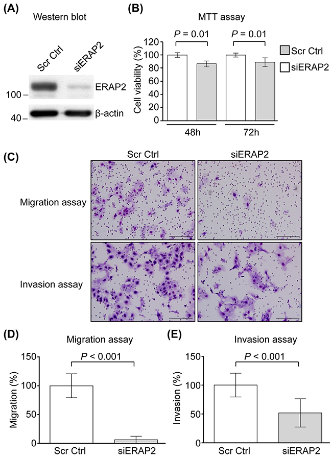 Involvement of ERAP2 in viability, migration, and invasion of OSCC cells.