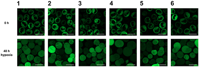 Analysis of the subcellular localization of GFP-HO-1 in the positively characterized stable K562 cell lines 1-6 after 48 h hypoxia (1 % O2) by confocal laser scanning microscopy.