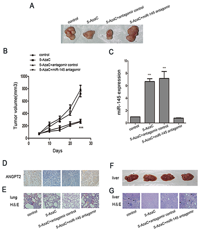 Treatment with 5-AzaC with or without miR-145 antagomir modulated invasion and metastasis in tumor-bearing nude mice.