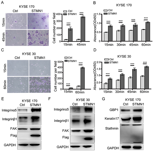 Stathmin increased ESCC cell adhesion to FN by promoting integrin&#x03B1;5&#x03B2;1/FAK expression.