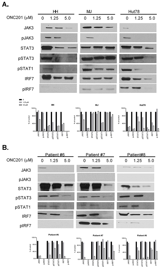 ONC201 downregulates JAK/STAT in CTCL cell lines and primary S&#x00E9;zary cells.