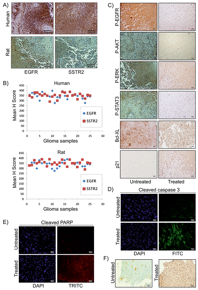 SSTR2pep-DIM-NP mediated inhibition of EGFR pathway in vivo.