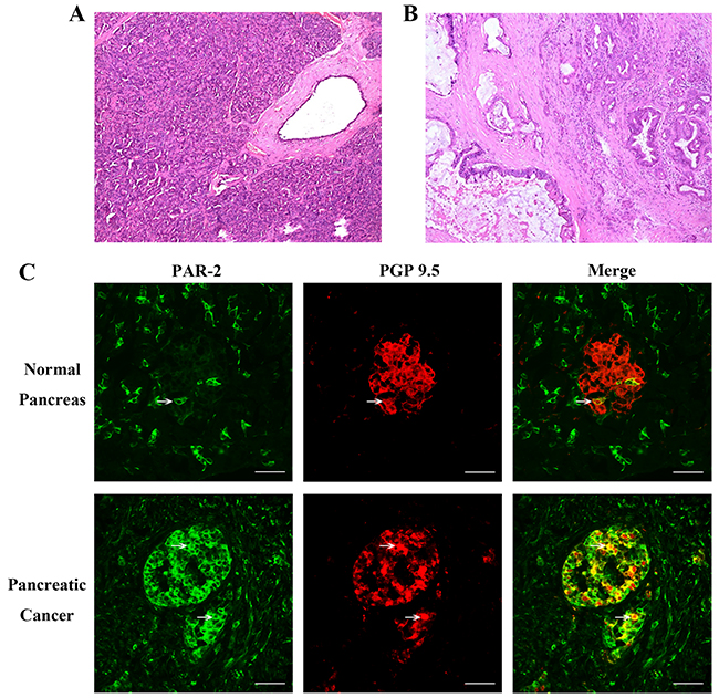 Histology of pancreatic tissue specimens and immunofluorescence assay for PAR-2 and PGP 9.5 in human pancreatic tissue specimens.
