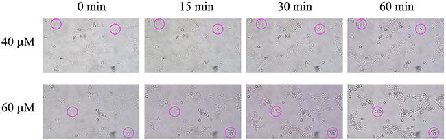 Effect of 2-AAPA on cell morphology in TE-13 cells.