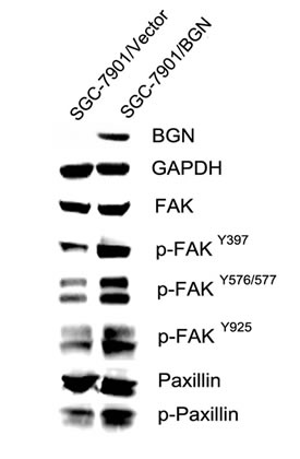 Fig.5: BGN regulates FAK signaling in gastric cancer cells.