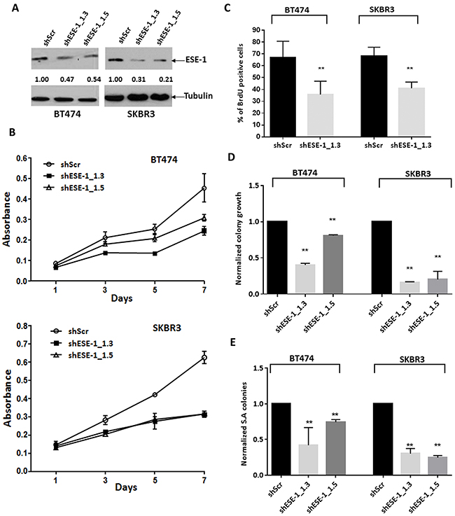 ESE-1 KD inhibits the transformation phenotype in BT474 and SKBR3 HER2+ cells.