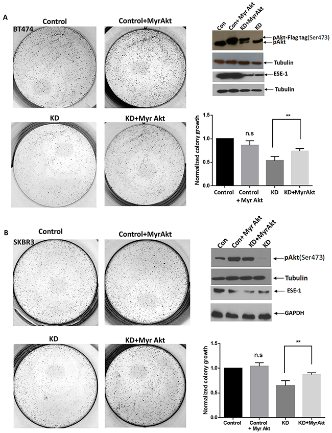 Constitutively active Akt partially rescues ESE-1 KD mediated inhibition in growth.
