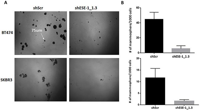 ESE-1 KD inhibits tumorsphere formation in BT474 and SKBR3 cells.