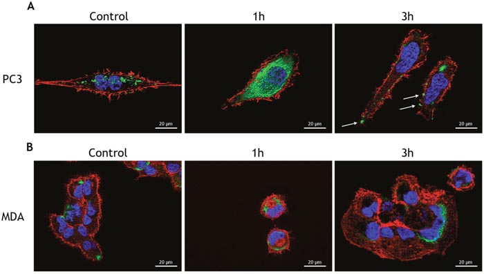 Tunicamycin treatment induces the translocation of Bip to the cell surface.
