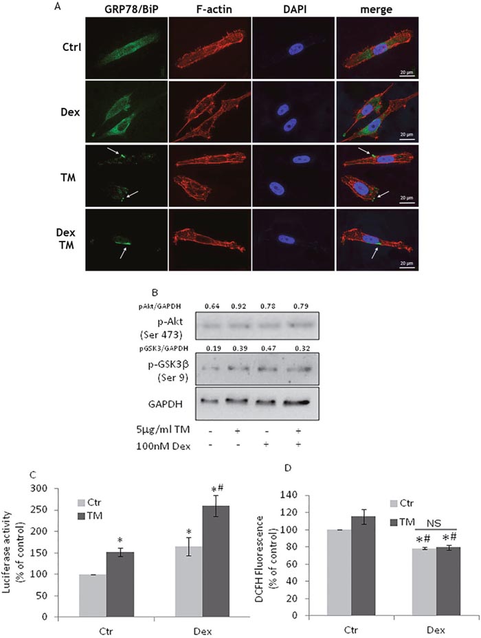 Dexamethasone treatment of PC3 cells does not affect GRP78/BiP translocation.