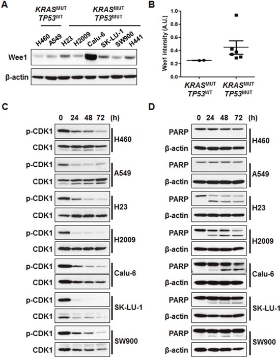 AZD1775 induces cell death regardless of p-CDK1 inhibition.