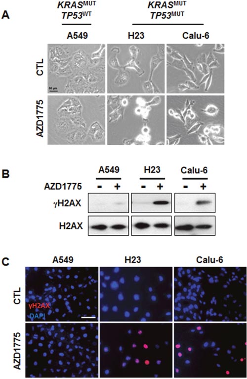 AZD1775 treatment causes DNA damage in KRASMUT/TP53MUT lung cancer.