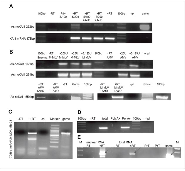 KAI1 as-lncRNA; analysis via RT-PCR.