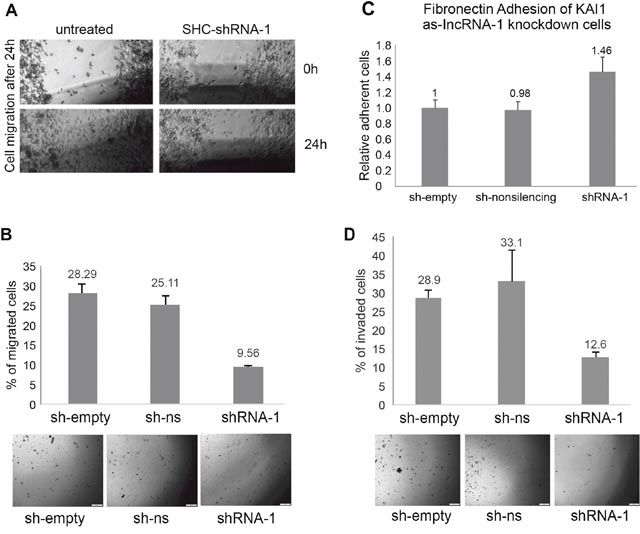 Phenotypic analysis of MDA-MB-231 knocked down for KAI1 as-lncRNA following SHC-shRNA-1 lentiviral infection.