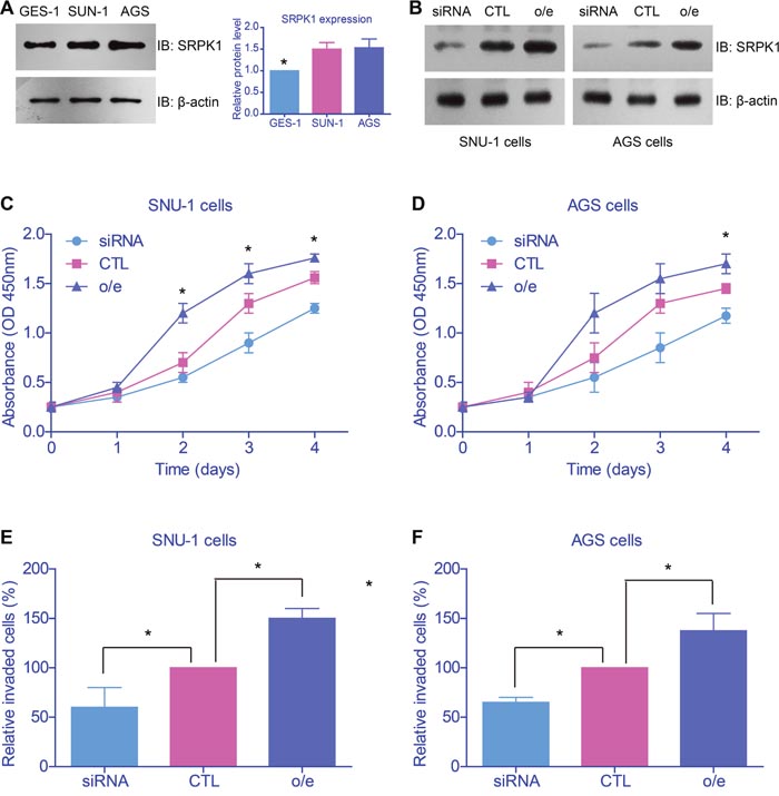 SRPK1 promoted proliferation and invasion of gastric cancer cell lines.