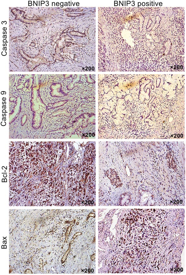 Correlation between BNIP3 expression and apoptosis-associated proteins.