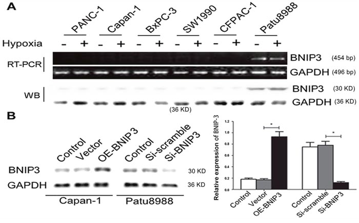 BNIP3 expression in pancreatic cancer cell lines under normoxic and hypoxic conditions.