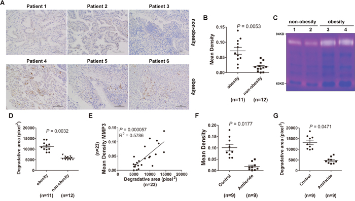 Lung tumor tissues from obese tumor patients exhibited increased MMP3 protein levels and MMP9 activity.