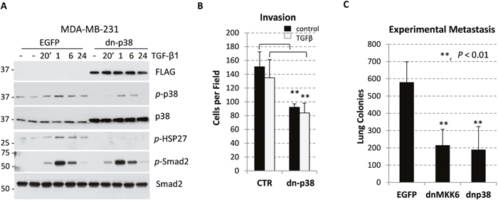 p38MAPK contributes to breast carcinoma invasion and metastasis.