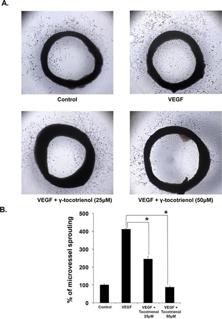 &#x3b3;-Tocotrienol inhibits VEGF-induced microvessel sprouting