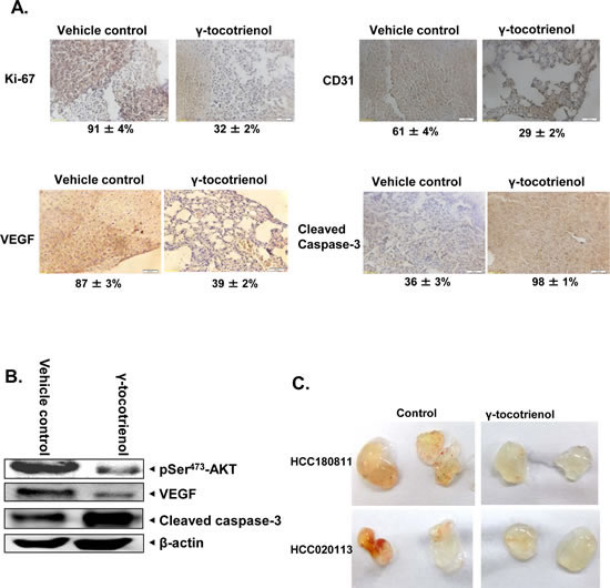 &#x3b3;-tocotrienol modulates the expression of various oncogenic biomarkers in tumor tissues.