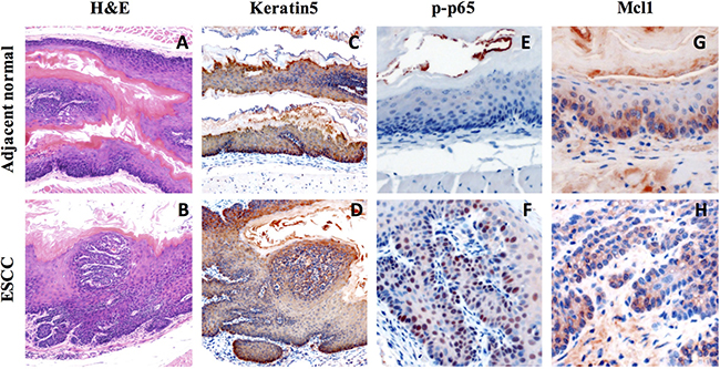 Increase expression of inflammation marker and Mcl-1 in 4NQO-induced mouse ESCC.