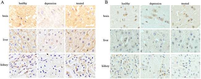 Expression and localization of TPH1/2 in rat tissues.