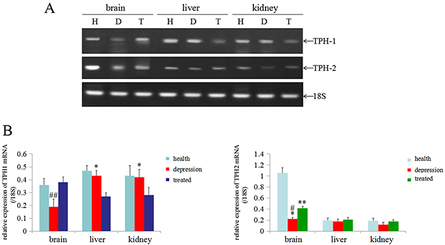 Expression of the TPH1/2 mRNAs in rat tissues.