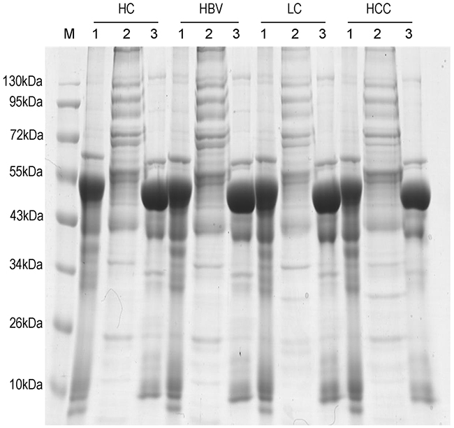 Sodium dodecyl sulfate polyacrylamide gel electrophoresis (SDS-PAGE) of serum after depletion of high-abundance proteins.