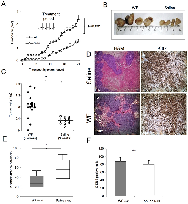 Malignant WF increases tumor growth in in vivo models.