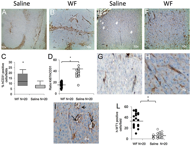 Tumor vessel determination and characterization.