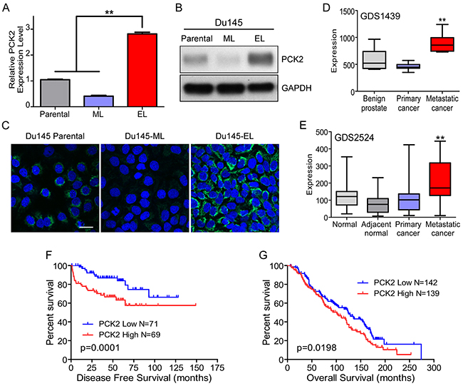 PCK2 is highly expressed in TIC-enriched prostate cancer cells and is a prognostic indicator for prostate cancer patients.