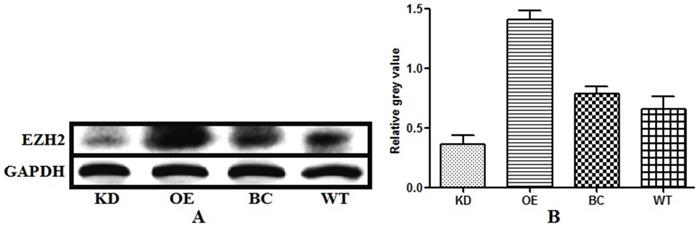 Levels of endogenous enhancer of zeste homolog 2 (EZH2) expression in bladder cancer cells with EZH2 knockdown, EZH2 overexpression, blank vector, and wild-type cells EZH2 expression levels were measured using western blot analysis.
