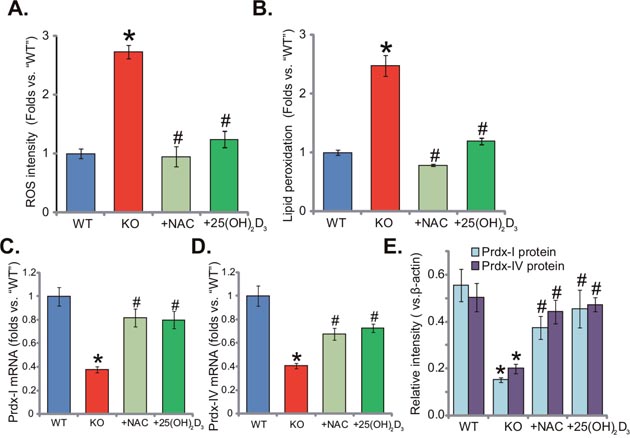 Supplement with NAC or 1,25(OH)2D3 alleviates oxidative stress in 1&#x03B1;(OH)ase KO mice liver.