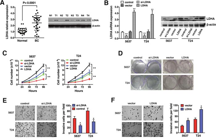 LDHA is up-regulated and promotes cell proliferation and invasion in bladder cancer.