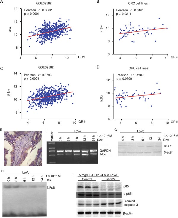 Dexamethasone suppresses NF-&kappa;B activity in colon cancer.