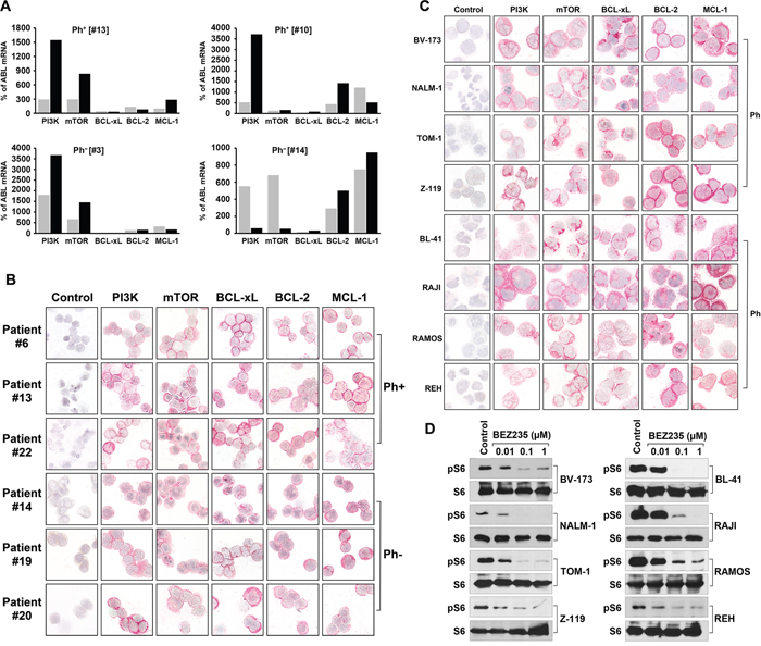 Expression of molecular targets in ALL cells.